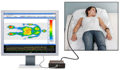 Fig 1: Contact Pressure Mapping Study Using the Tactilus Bodyfitter System contact pressure mapping