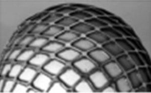 Fig 1: Grid Over Egg