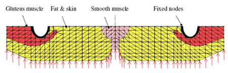 Fig 3: Time-dependent Contact Pressure with FE Mesh and Boundary Conditions contact pressure