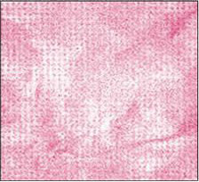 Horn's Patter on Pressurex® Film reveals Contact Flaws