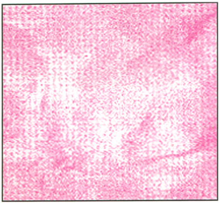 Pressurex Image figure 2