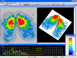 Pressure profile of rider’s buttocks and thighs on a saddle.