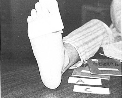 Figure 3. Rectangular film patch taped to subject's foot. figure 3