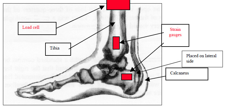 Figure 4: Instrumentation Placement figure 4