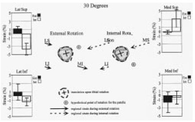 Figure 7. Histograms and illustration showing strain in peripatellar retinaculum figure 1