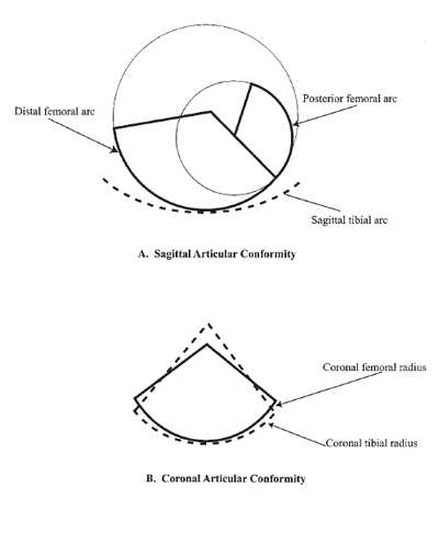 Fig 2A–B. Articular conformity between tibial and femoral surfaces is shown. (A) Sagittal conformity and (B) coronal conformity are shown. figure 1