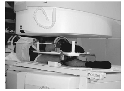 Fig. 1.Photograph showing a patient lying on his side on the MR open table. The positioning device allows for reproducible alignment of the knee flexion angle, and avoids motion artifacts during image figure 1
