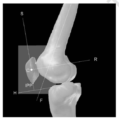 Fig. 2. Patellar-based coordinate system (sagittal view). C: centroid; S: first axis; R: third axis; H: second eigenvector of the tibia plateau; F: figure 2