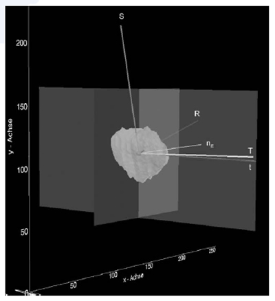 Principal axis determination of the patellar-based coordinate figure 4
