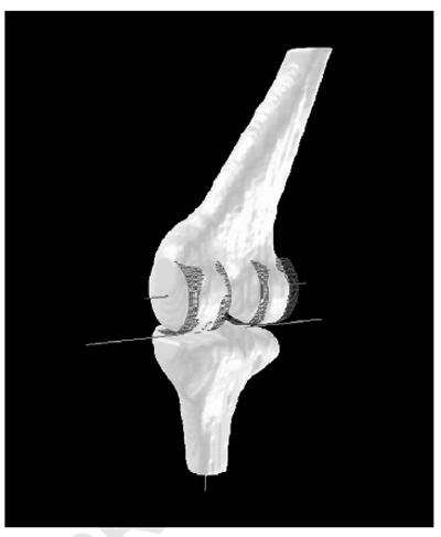 Principal axis determination of the patellar-based coordinate figure 5