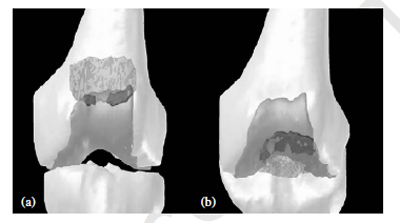 Fig. 6. Patello-femoral contact areas: figure 6