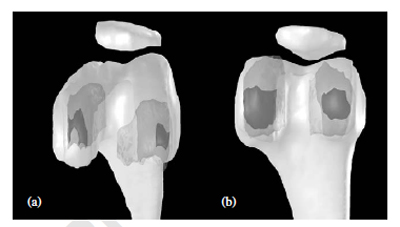 Fig. 7. Tibio-femoral contact areas:: figure 7