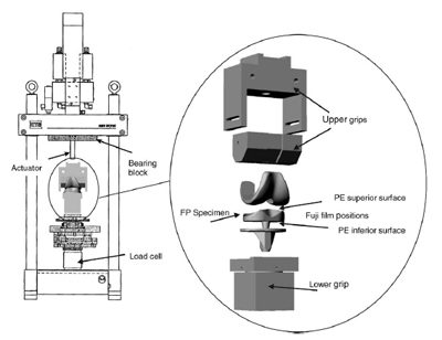 Fig. 1.Photograph showing a patient lying on his side on the MR open table. The positioning device allows for reproducible alignment of the knee flexion angle, and avoids motion artifacts during image figure 1