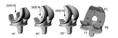 Fig. 2. The three configurations tested with the corresponding loads and a posterior view of the meshes of the FC, the PE insert and the TT. figure 2