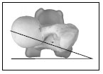 Biomechanics Abb. 2.18: Antetorsionswinkel am rechten Os femoris.