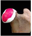 Biomechanics Abb. 3.18: Femurkopf mit Paraffinkappe, auf der die Kontaktfläche rot markiert wurde.