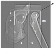 Biomechanics Abb. 3.5: Topogramm, Hemipelvis links, Os femoris rechts, unterlagert vom Phantom. 1 Facies lunata, 2 Os ilium, 3 Os pubis, 4 Os ischii, 5 For. obturatum, 6 Caput ossis femoris, 7 Femurschaft, 8 Phantom, Wasseräquivalent, 9 Phantom, Spongiosaäquivalent, ROI = Region of interest.