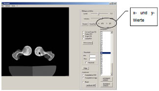 Biomechanics Abb. 3.9: Ablesen der x- und y- Koordinaten im Programm MEASURE.