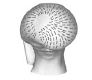 Biomechanics Abb. 4.16: Schematische Darstellung der Spaltlinien des Gelenkknorpels an der Medialfläche des Caput ossis femoris; um die Fovea capitis herum sind die Spalten strahlenförmig angeordnet.