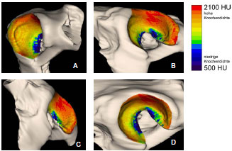 Biomechanics Abb. 4.19: Verteilungsmuster der subchondralen Knochendichte im Acetabulum eines ca. 6 Jahre alten, männlichen Dobermanns; A Kranialfläche, B Dorsalfläche, C Kaudalfläche, D gesamte Gelenkfläche im Überblick.