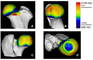 Biomechanics Abb. 4.21: Knochendichteverteilung am Femurkopf eines Zwergschnauzer-Mischlings, ca. 4 Jahre alt, weiblich; A Kranialfläche, B Medialfläche, C Kaudalfläche, D Dorsalfläche.