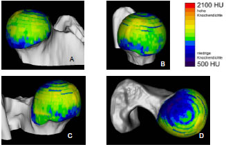 Biomechanics Abb. 4.22: Knochendichteverteilung am Femurkopf eines Berner Sennenhund-Mischlings, ca. 2 Jahre alt, männlich; A Kranialfläche, B Medialfläche, C Kaudalfläche, D Dorsalfläche.