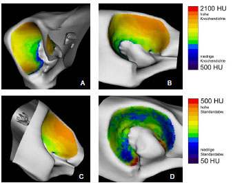 Biomechanics Abb. 4.23: Darstellung der mittleren Knochendichte (A-C) und der Standardabweichung (D) im Acetabulum; A Kranialfläche, B Dorsalfläche, C Kaudalfläche des Acetabulum, D gesamte Gelenkfläche.