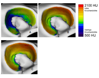 Biomechanics Abb. 4.24: Mittelwert der subchondralen Knochendichte im Acetabulum dargestellt an einer Referenzgelenkfläche; A Gruppe 'jung', B Gruppe 'mittleres Alter', C Gruppe 'alt'.