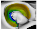 Biomechanics Abb. 4.25: Mittelwert der subchondralen Knochendichte im Acetabulum der Gruppe 'weiblich' dargestellt an einer Referenzgelenkfläche.