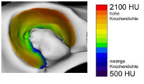 Biomechanics Abb. 4.26: Mittelwert der subchondralen Knochendichte im Acetabulum der Gruppe 'männlich' dargestellt an einer Referenzgelenkfläche.