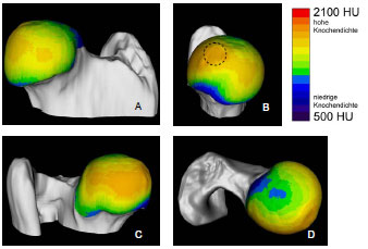 Biomechanics Abb. 4.28: Darstellung der mittleren Knochendichte am Caput ossis femoris, Kranialfläche, B Medialfläche; gestrichelter Kreis = Fovea capitis, C Kaudalfläche, D Dorsalfläche.