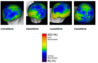 Biomechanics Abb. 4.29: Darstellung der Standardabweichung der mittleren Knochendichte am Caput ossis femoris, die blauen Bereiche markieren Stellen, die eine niedrige Standardabweichung aufweisen; sie entsprechen den dargestellten mittleren Knochendichtemaxima im obigen Summationsbild.