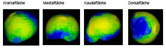 Biomechanics Abb. 4.30: Darstellung der mittleren Knochendichte der Gruppe 'jung' am Caput ossis femoris.