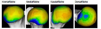Biomechanics Abb. 4.33: Darstellung der mittleren Knochendichte der Gruppe 'weiblich' (n=10) am Caput ossis femoris.