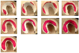 Biomechanics Abb. 4.39: Fotoserie Kontaktflächen, Ansicht eines linken Acetabulum von lateral, Bobtail-Mischling (w1 159), 24 kg, weiblich, 10 Jahre alt; 1-9 Belastungsstufen rel. zum Körpergewicht; 1) 25%, 2) 50%, 3) 75%, 4) 100%, 5) 150%, 6) 200%, 7) 250%, 8) 300% 9) 400% des Körpergewichts.