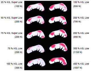 Biomechanics Abb. 4.42: Filmserie einer linken Facies lunata, Golden Retriever, ca. 6 Jahre, weiblich, 31,5 kg, (w1 157); die Belastungsstufen sind mit % KG definiert, die ersten 3 Belastungsstufen wurden mit dem super low type Film und die restlichen 7 Belastungsstufen mit dem low type Film durchgeführt.