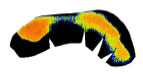 Biomechanics Abb. 4.48: Fuji Druckmessfolie (Low type), falschfarbene Darstellung der Höhe der Kontaktdrücke bei einer Lasteinleitung von 400% KG bei Hund w1 157.
