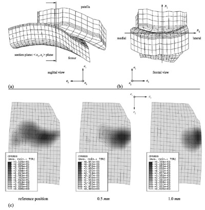 Fig. 1. Patellofemoral joint contact mesh model: (a) sagittal view, with the section plane on which the local contact pressure was evaluated; figure 1