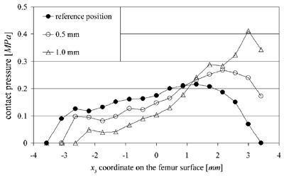 Fig. 3. Local contact pressures along a medial–lateral line for the three positions of the patella relative to the femur for the 3N loading condition. figure 3