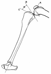 Biomechanics Abb. 1: Die Gerade A zieht von proximal durch die Eminentia intercondylaris nach distal durch die Mitte des Talus. Die Gerade B verläuft entlang der medialen Gelenkfläche. Die Gerade C steht senkrecht auf A im Schnittpunkt mit B. Der Winkel zwischen C und B ist der Tibiaplateauwinkel Ø (Caylor et al., 2001).
