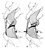 Biomechanics Abb. 3: Prüfung der Stabilität des Lig. cruciatum craniale bzw. Vorhandensein der vorderen Schublade. a Keine Verschieblichkeit; b Verschieblichkeit der Tibia nach vorderer Kreuzbandruptur nach kranial möglich (aus: Brunnberg, 1989b);