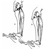 Biomechanics Abb. 4: Tibia-Kompressions-Test: a Keine Subluxation bei intaktem vorderen Kreuzband; b Subluxation des Tibiakopfes nach vorderer Kreuzbandruptur (aus: Brunnberg, 1989b);