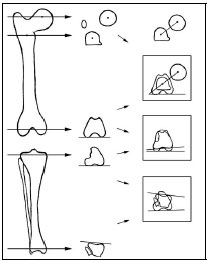 Biomechanics Abb. 14: Computertomographische Torsionsmessung an Femur und Tibia des Hundes. Links Übersichtsaufnahme mit Schnittebenen, Mitte Schichtaufnahmen (Tomogramme) und Bezugsachsen, rechts Winkeldarstellung im Additionsbild (aus Löer, 1998).