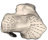 Biomechanics Abb. 21: Summationsbild der Knorpelspaltlinien an den Kondylen der linken Tibia (Ansicht von proximal).