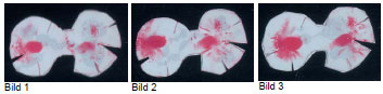 Biomechanics Abb. 28: Kontaktflächen bei steigenden Belastungsstufen (W2-26, rechts) Bild 1: Kontaktfläche in der Belastungsstufe 150%, 471N Bild 2: Kontaktfläche in der Belastungsstufe 200%, 628N Bild 3: Kontaktfläche in der Belastungsstufe 250%, 785N