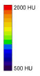 Biomechanics Abb. 31: Farbkodierung der Hounsfieldeinheiten.