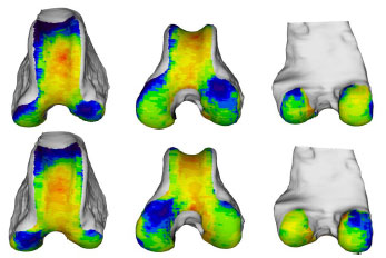 Biomechanics Abb. 32: Seitenvergleich der Knochendichteverteilung der Facies articularis femoris von linkem (oben) und rechtem (unten) Femur eines Mischlinghundes, männlich,21 kg, Altersgruppe III (Knie 28). Von links nach rechts: Ansicht von kranial, kraniodistal und kaudal.