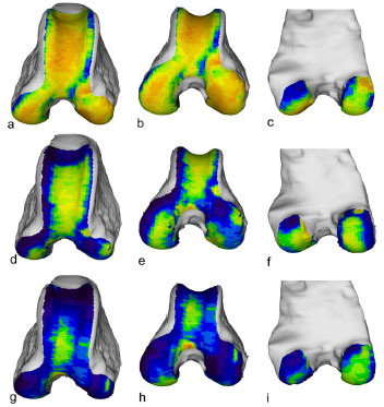 Biomechanics Abb. 33: Vergleichende Darstellung der individuellen Knochendichteverteilung der Facies articularis femoris von drei verschiedenen Hunden. a - c: linker Femur eines Boxers, weiblich, 23 kg, Altersgruppe III (Hd 33) d - f: linker Femur eines DSH, männlich, 25 kg, Altersgruppe II (Hd DSH1) g - i: linker Femur eines Pudels-Mischlings, männlich, 8 kg, Altersgruppe III (Hd Pu2) Von links nach rechts: Ansicht von kranial, kraniodistal und kaudal.