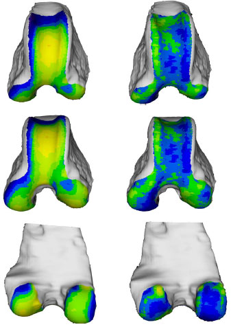 Biomechanics Abb. 35: Links, das aus den Mittelwerten aller 19 ausgewerteten Femora rekonstruierte Objekt. Rechts, Darstellung der Standardabweichung der 19 ausgewerteten Femora. (von oben nach unten: Ansicht von kranial, kraniodistal und kaudal)