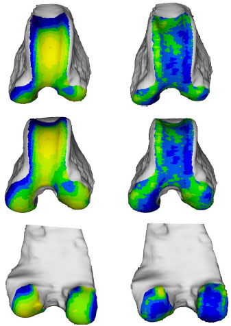 Biomechanics Abb. 36: Links, das aus den Mittelwerten aller 14 Hunde über 15 kg rekonstruierte Objekt. Rechts, Darstellung der Standardabweichung der 14 Femora. (von oben nach unten: Ansicht von kranial, kraniodistal und kaudal)